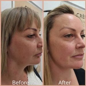 Matrix PDO Threads Result