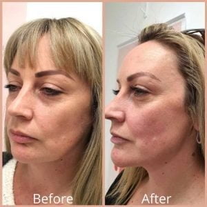 Matrix PDO Threads Result