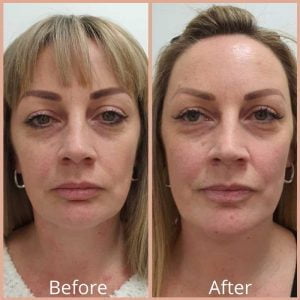 Matrix PDO Threads Result