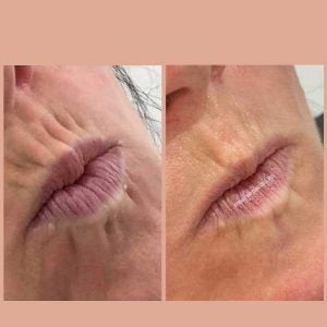 Matrix PDO Threads Result