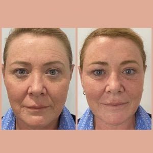 Matrix PDO Threads Result